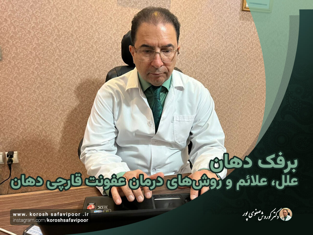 برفک-دهان-علل-علائم-درمان-عفونت-قارچی-دهان-1200x900.jpg